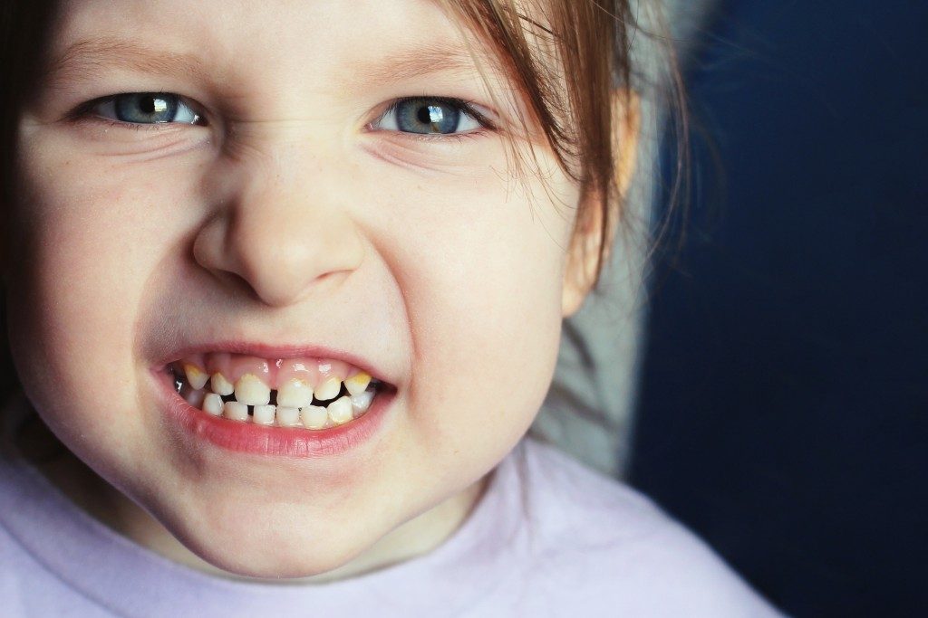 a kid's teeth