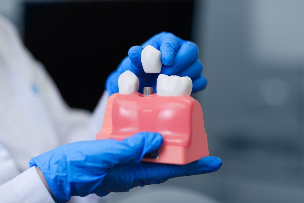 dentist holding a teeth model