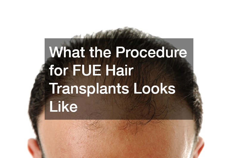 What the Procedure for FUE Hair Transplants Looks Like